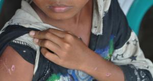 Human vaccination
